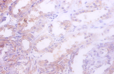 IDH1 Polyclonal Antibody