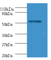 GLP1R Polyclonal Antibody