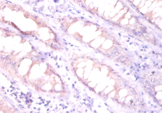 EPO Polyclonal Antibody