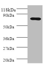 Western blot<br />All lanes: PIGR Polyclonal Antibody at 2ug/ml+HL-60 whole cell lysate<br />Secondary<br />Goat polyclonal to Rabbit IgG at 1/10000 dilution<br />Predicted band size: 83, 59 kDa<br />Observed band size: 82 kDa<br />