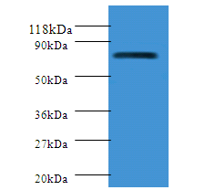 PIGR Polyclonal Antibody