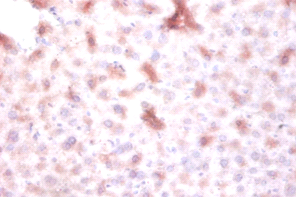 DTWD1 Polyclonal Antibody