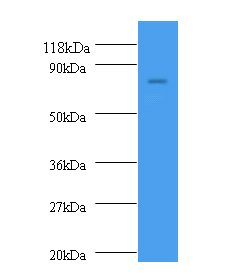 Western blot<br />All Lanes: nrdD Polyclonal Antibody at 2/ml+293T whole cell lysate<br />Secondary<br />Goat polyclonal to Rabbit IgG at 1/10000 dilution<br />Predicted band size: 78kDa <br />Observed band size: 78kDa <br />