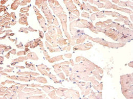 Immunohistochemistry of paraffin-embeded mouse heart using HNRNPA1 Polyclonal Antibody at dilution of 1:100