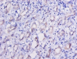 EEF2 Polyclonal Antibody