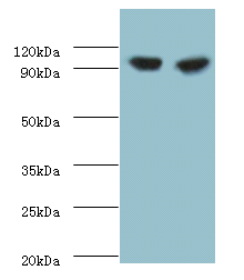 PYGL Polyclonal Antibody