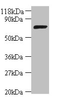 Western blot<br />All lanes: ligA Polyclonal Antibody at 2ug/ml+DH5a whole cell lysate<br />Secondary<br />Goat polyclonal to Rabbit IgG at 1/10000 dilution<br />Predicted band size: 74 kDa<br />Observed band size: 74 kDa<br />