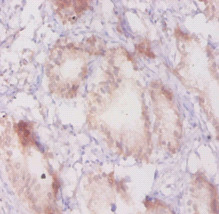 ADRBK1 Polyclonal Antibody