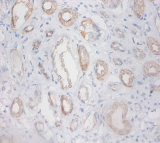 ZNF91 Polyclonal Antibody