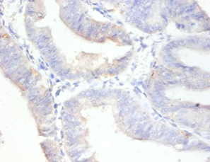 MKI67 Polyclonal Antibody