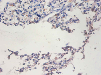 TERT Polyclonal Antibody