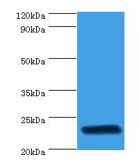 Western blot<br />All Lanes: rpiA Polyclonal Antibody at 2ug/ml+DH5a whole cell lysate<br />Secondary<br />Goat polyclonal to Rabbit IgG at 1/10000 dilution<br />Predicted band size: 23kDa <br />Observed band size: 23kDa <br />