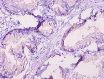 ROR1 Polyclonal Antibody