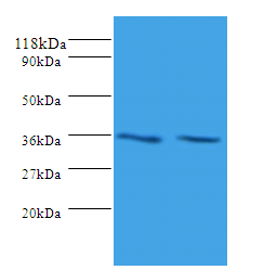 SNX20 Polyclonal Antibody