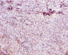 Immunohistochemistry of paraffin-embedded human tonsil at dilution 1:10