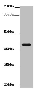 Western blot<br />All lanes:IL12B Polyclonal Antibody at 14ug/ml+ K562 whole cell lysate<br />Goat polyclonal to rabbit at 1/10000 dilution<br />Predicted band size: 37 kDa<br />Observed band size: 37 kDa<br />