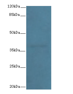 IL12B Polyclonal Antibody