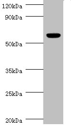 Western blot<br />All lanes: CHRNA1 Polyclonal Antibody at 2ug/ml+rat skeletal muscle <br />Secondary<br />Goat polyclonal to Rabbit IgG at 1/10000 dilution<br />Predicted band size: 55, 52 kDa<br />Observed band size: 55 kDa<br />