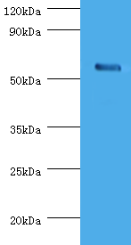 CHRNA1 Polyclonal Antibody