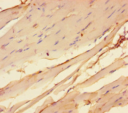 Immunohistochemistry of paraffin-embedded human skeletal muscle tissue at dilution of 1:100