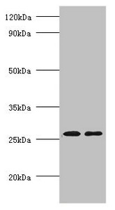 ADIPOQ Polyclonal Antibody