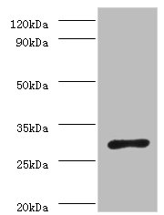 Western blot<br />All lanes: ureA Polyclonal Antibody at 2ug/ml+Helicobacter pylori bacteria liquid <br />Secondary<br />Goat polyclonal to rabbit at 1/10000 dilution<br />Predicted band size: 27kDa<br />Observed band size: 27kDa<br />