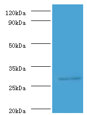 ureA Polyclonal Antibody