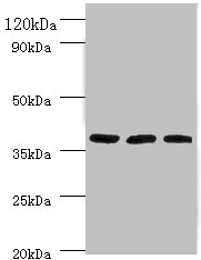 FTSJ1 Polyclonal Antibody (100 µl)