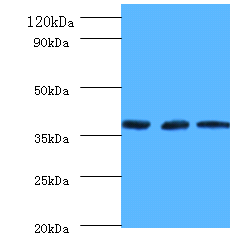 FTSJ1 Polyclonal Antibody