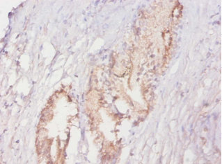 ACPP Polyclonal Antibody (50 µl)