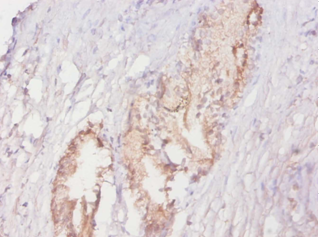 ACPP Polyclonal Antibody