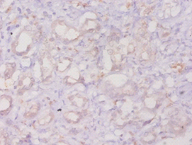 ANXA3 Polyclonal Antibody