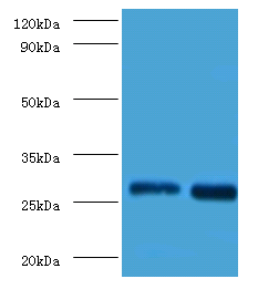 LGALS3 Polyclonal Antibody