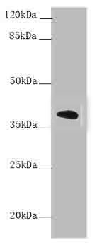 Western blot<br />All lanes: AMBP Polyclonal Antibody at 1.5ug/ml+Mouse liver tissue<br />Goat polyclonal to rabbit IgG at 1/10000 dilution<br />Predicted band size: 39 kDa<br />Observed band size: 39 kDa<br />