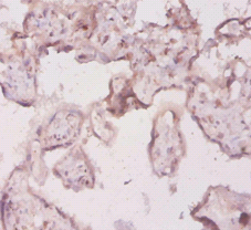 IL18 Polyclonal Antibody (20 µl)