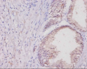 Col1a1 Polyclonal Antibody