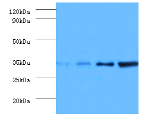 GTF2E2 Polyclonal Antibody