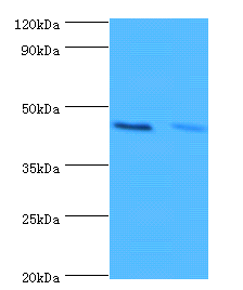Hba Polyclonal Antibody