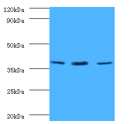 IDH3B Polyclonal Antibody