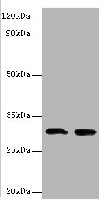IL1B Polyclonal Antibody (20 µl)