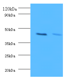 KCNJ1 Polyclonal Antibody
