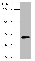Western blot<br />All lanes: glsA1 Polyclonal Antibody at 2ug/ml+DH5 alpha; whole cell lysate<br />Secondary<br />Goat polyclonal to rabbit at 1/10000 dilution<br />Predicted band size: 33kDa<br />Observed band size: 33kDa<br />