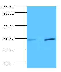 Plau Polyclonal Antibody