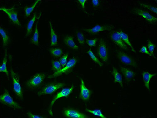 TSHR Polyclonal Antibody