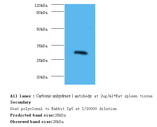 Ca1 Polyclonal Antibody