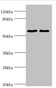 ESR2 Polyclonal Antibody (100 µl)