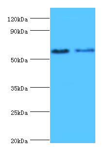 ESR2 Polyclonal Antibody