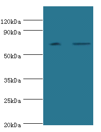 PARN Polyclonal Antibody