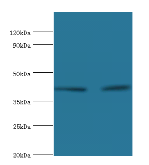 LIPA Polyclonal Antibody