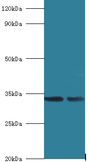 MRPL19 Polyclonal Antibody